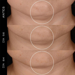 Lancôme Rénergie H.P.N. 300 Peptide Cream Recharge 50Ml