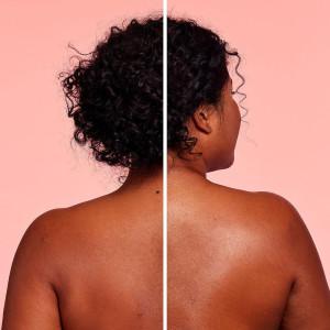 Body Superfood Bálsamo Corporal Hidratante Hipoalergénico 380 Ml