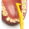 Cepillo Interdental - Tepe Angle (0.7 Mm Amarillo)