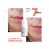 Cleanance Comedomed Concentrado Anti-imperfecciones, 30 ml. - Avene 