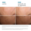 Discoloration Defense Sérum, 30 ml. - Skinceuticals