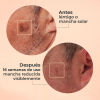 Glicolmix Sérum Exfoliante Facial, 30 ml. - Segle Clinical