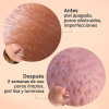 Glicolmix Sérum Exfoliante Facial, 30 ml. - Segle Clinical