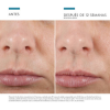H.A Intensifier, 30 ml. - Skinceuticals