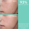 Just Bee Clear, Crema Anti-Imperfecciones Matificante Hidratante, 40 ml. - Apivita