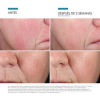 Phyto Corrective Essence Mist, 50 ml. - Skinceuticals