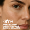 Set Tratamiento Anti-imperfecciones y Rojeces. -Segle Clinical