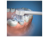 Irrigador Bucal Electrico Recambio - Waterpik Wp- 100 /Wp 450 (Boquilla Cepillo De Dientes)
