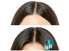 L'oréal Scalp Advanced Anti - Discomfort Dermo - Regulator Shampoo 300ml - L'oral