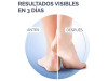 Crema Talones Agrietados K+ (1 Envase 60 ml) - Reckitt Benckiser