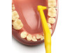 Cepillo Interdental - Tepe Angle (0.7 mm Amarillo) - Inibsa
