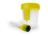Alvita Envase Recogida Orina, Tubo de Vacio, Kit Esteril - Alliance Healthcare