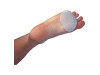 Almohadilla Metatarsal - Hydrogel Varisan (con Anillo) - Farmavari S a
