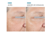 A.G.E. Advanced Eye, 15 ml. - Skinceuticals