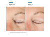 A.G.E. Advanced Eye, 15 ml. - Skinceuticals