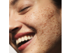 Crema Exfoliante Limpiadora, 100 ml. - Primaderm