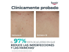 DermoPure Clinical Crema Corporal Correctora, 200 ml. - Eucerin