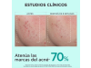 Just Bee Clear Sérum Anti-Imperfecciones y Marcas, 30 ml.- Apivita