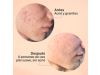 Exfoliante AHA/BHA, 30 ml. - Segle Clinical