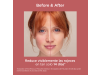 Fotoultra Redness SPF 50, 50 ml. - Isdin 