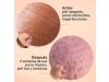 Glicolmix Sérum Exfoliante Facial, 30 ml. - Segle Clinical
