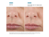 H.A Intensifier, 30 ml. - Skinceuticals