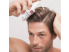 Hair System Loción Anticaída, 100 ml. - Martiderm
