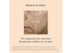 Isdinceutics Melaclear Sérum, 30 ml. - Isdin