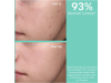 Just Bee Clear, Crema Anti-Imperfecciones Matificante Hidratante, 40 ml. - Apivita