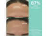 Just Bee Clear, Loción Purificante Minimizador, 200 ml. - Apivita