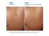 Phyto A+ Brightening Treatment, 30 ml. - Skinceuticals