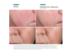 Phyto Corrective Essence Mist, 50 ml. - Skinceuticals
