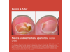 SI-NAILS® MicoXpert MD, 4.5 ml. - Isdin