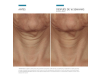Tripeptide-R Neck Repair, 50 ml. - Skinceuticals 