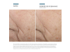 Triple Lipid Restore 2:4:2, 48 ml. - Skinceuticals