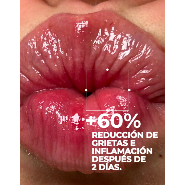 Balsamo Labial Ultra Repair Centella Peach, 10 ml. - Segle Clinical