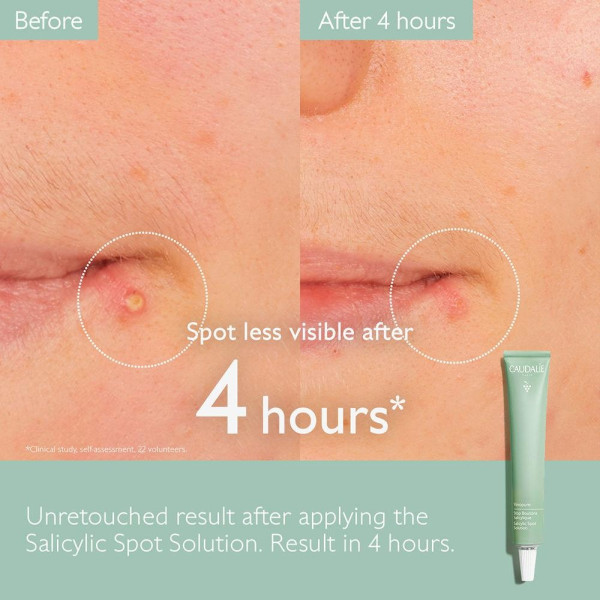Vinopure Salicylic Spot Solution 15 Ml