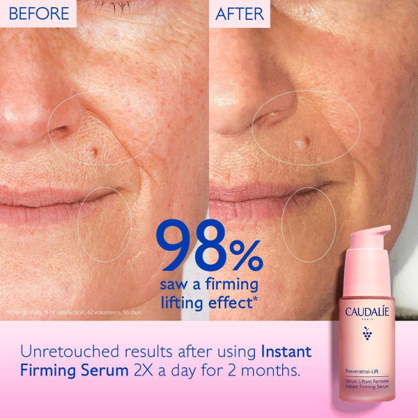 Resveratrol Lift Sérum Lifting Firmeza Recarga 30 Ml