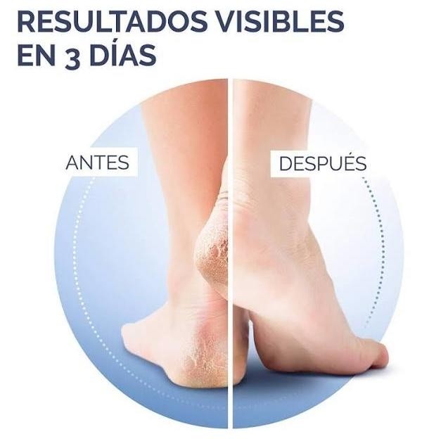 Crema Talones Agrietados K+ (1 Envase 60 Ml)