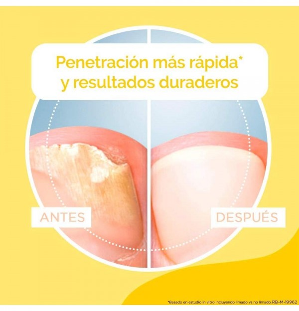 Dr Scholl Antihongos Tratamiento Uñas (1 Envase 3,8 Ml + 5 Limas)