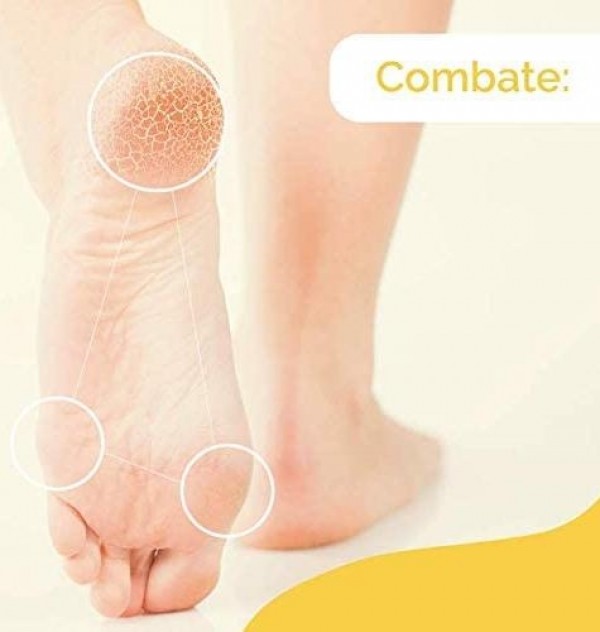 Scholl Crema Durezas (1 Envase 60 Ml)