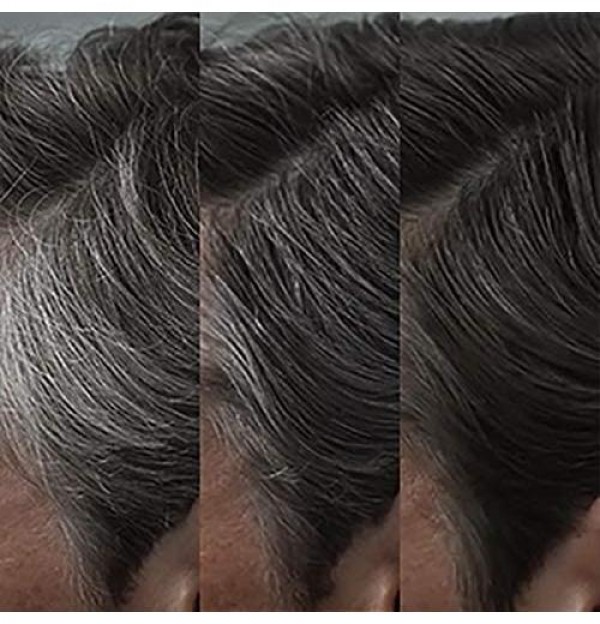 Control Gx Reductor De Canas Champu (1 Envase 147 Ml)