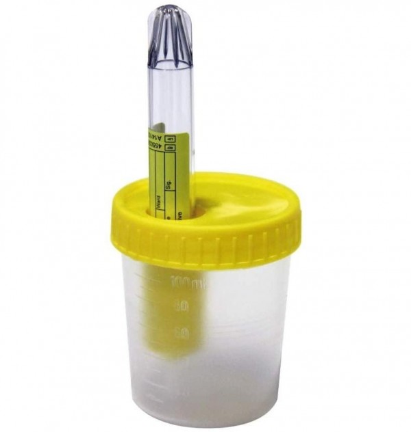 Alvita Envase Recogida Orina, Tubo De Vacio, Kit Esteril. -  Alliance Healthcare