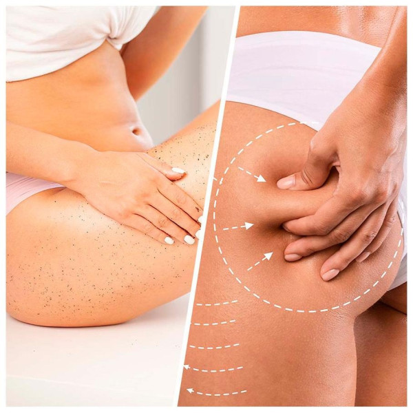 Biovene Niacin Cellulite Scrub Extra Firming 250Ml