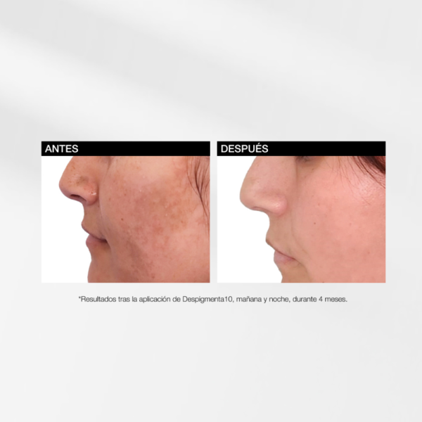  Despigmenta10 Crema Antimanhas  Iluminadora, 50 ml. - Bella Aurora Labs