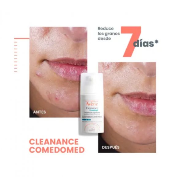 Cleanance Comedomed Concentrado Anti-imperfecciones, 30 ml. - Avene 