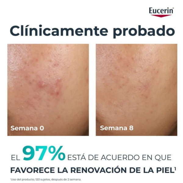 DermoPure Clinical Peeling 10, 40 ml. - Eucerin