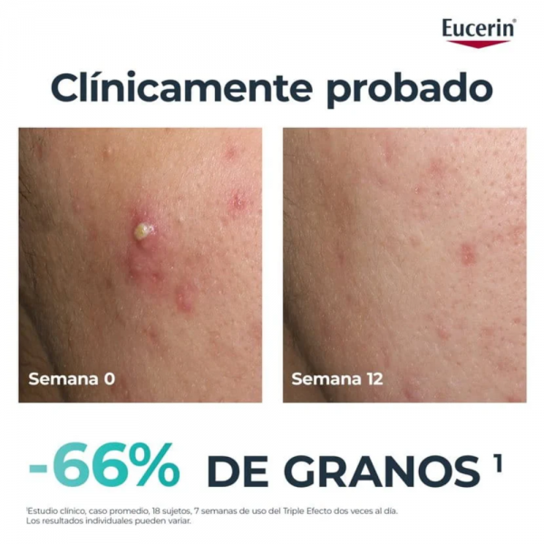 DermoPure Clinical Triple Action, 40 ml. - Eucerin 