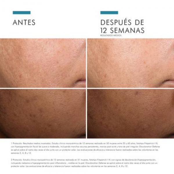 Discoloration Defense Sérum, 30 ml. - Skinceuticals