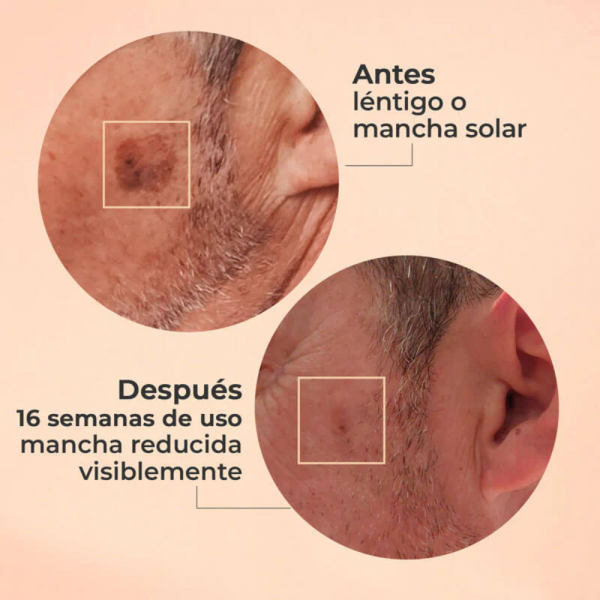 Glicolmix Sérum Exfoliante Facial, 30 ml. - Segle Clinical